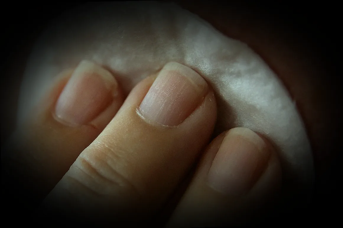 երեխայի ատոպիկ դերմատիտի ժամանակ մաշկի խնամքը